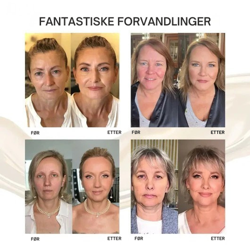 Elane-Din hud. Din perfekte match.